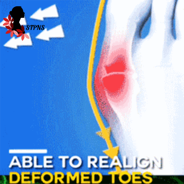 STPNS Women Comfy Platform Sandal Shoes