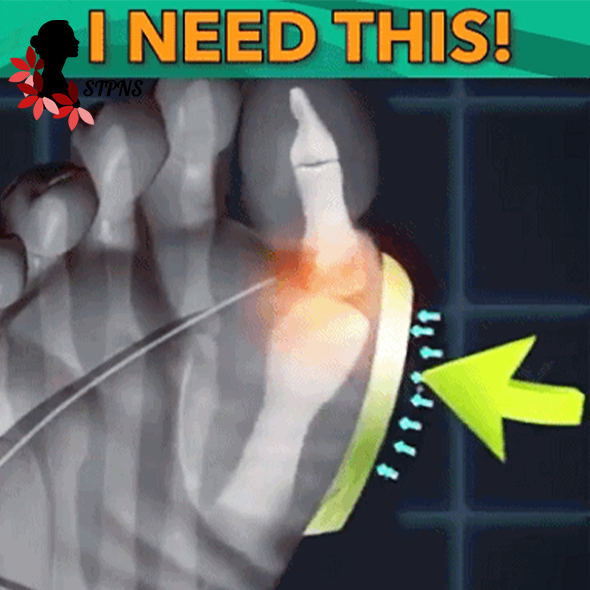 STPNS Women Comfy Platform Sandal Shoes