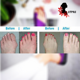 STPNS Women Comfy Platform Sandal Shoes